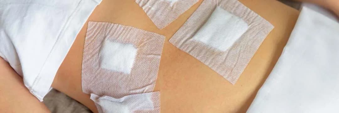 Plastry na rany pooperacyjne: Jak stosować? Oto poradnik pacjenta